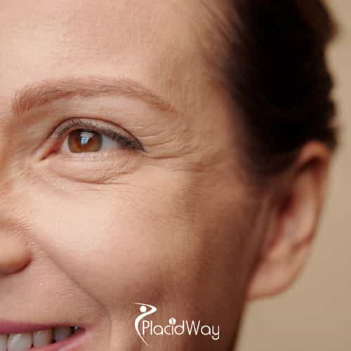LASIK Surgery in Thailand: A Complete Guide for Australian Patients